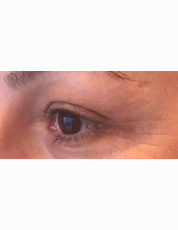 eyes-after-w