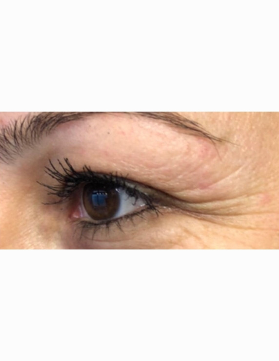 eyes-before-w