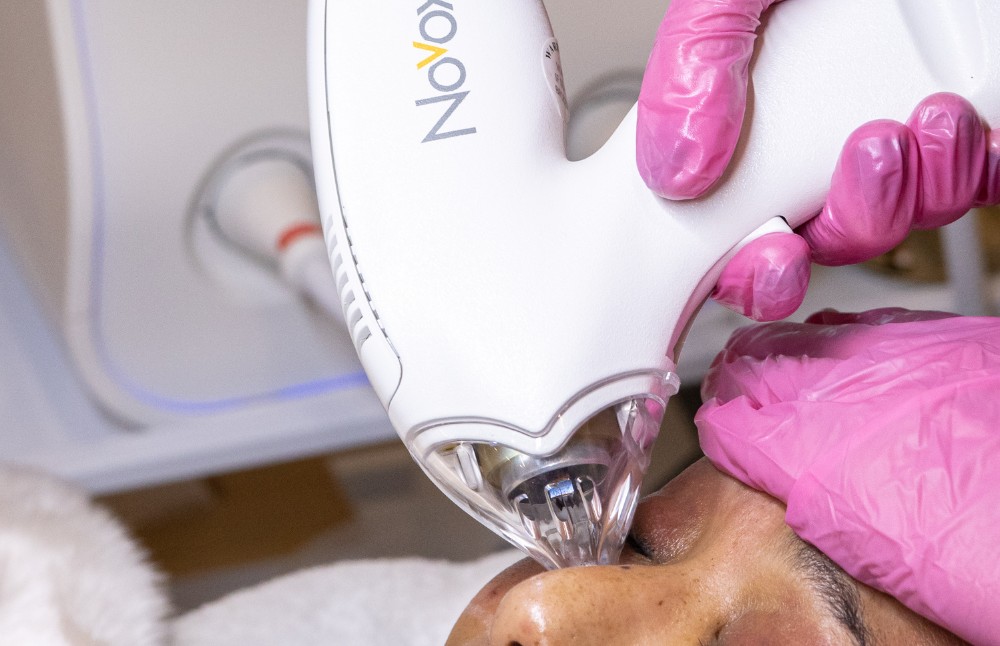 tixel-handpiece-treatment-closeup
